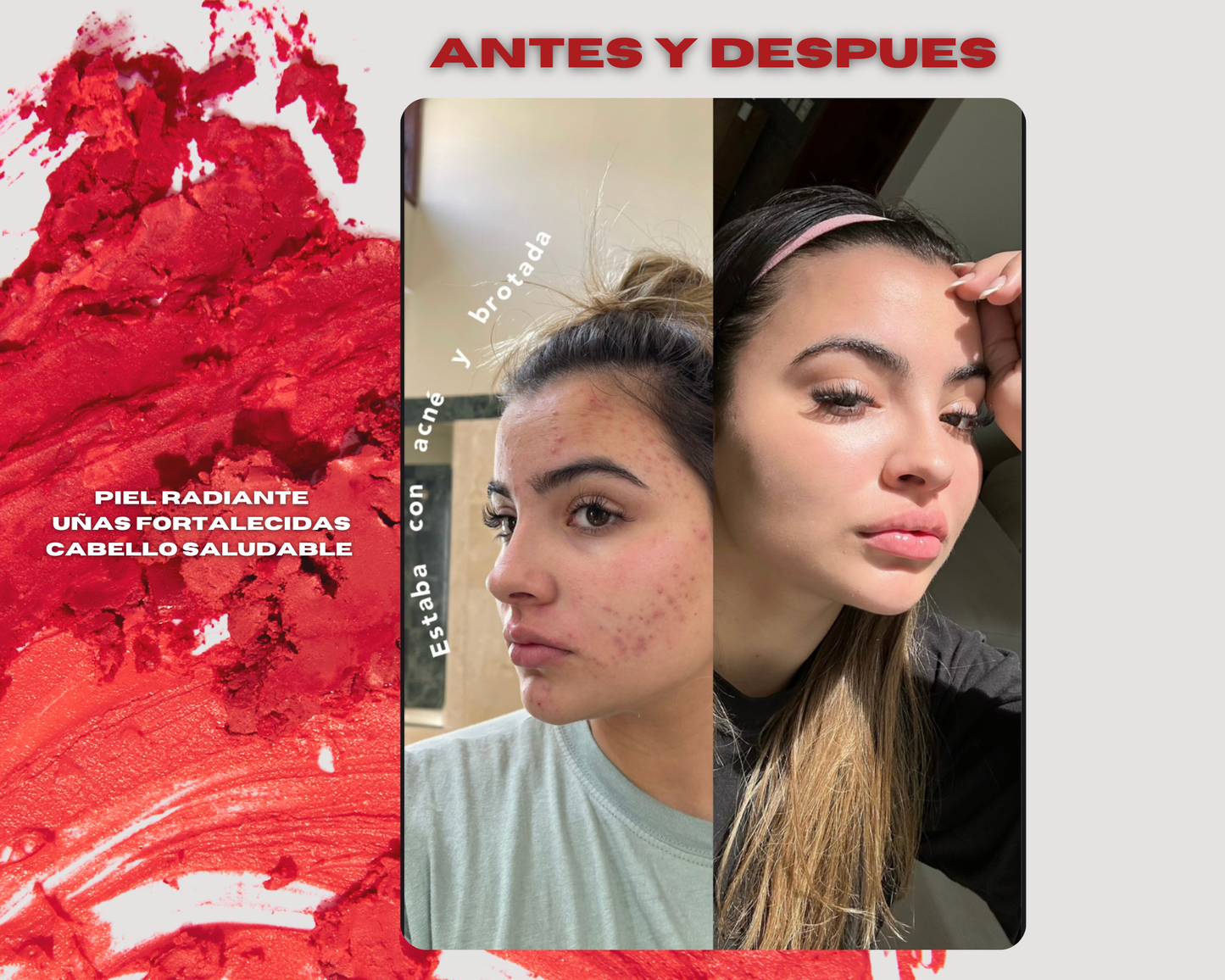 COLAGENO RENOVA😍💅🎀