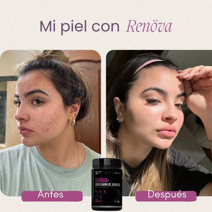 COLAGENO RENOVA😍💅🎀